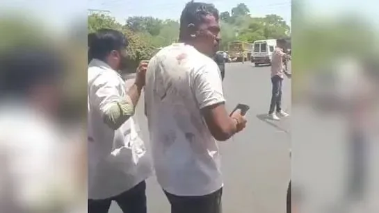 Hindistan’daki uçak kazasından 1 yolcu sağ kurtuldu, ambulansa yürüyerek gitti