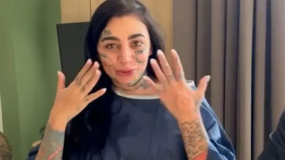 Sosyal medya fenomeni, İstanbul’da geçirdiği estetik ameliyatı sonrası hayatını kaybetti 